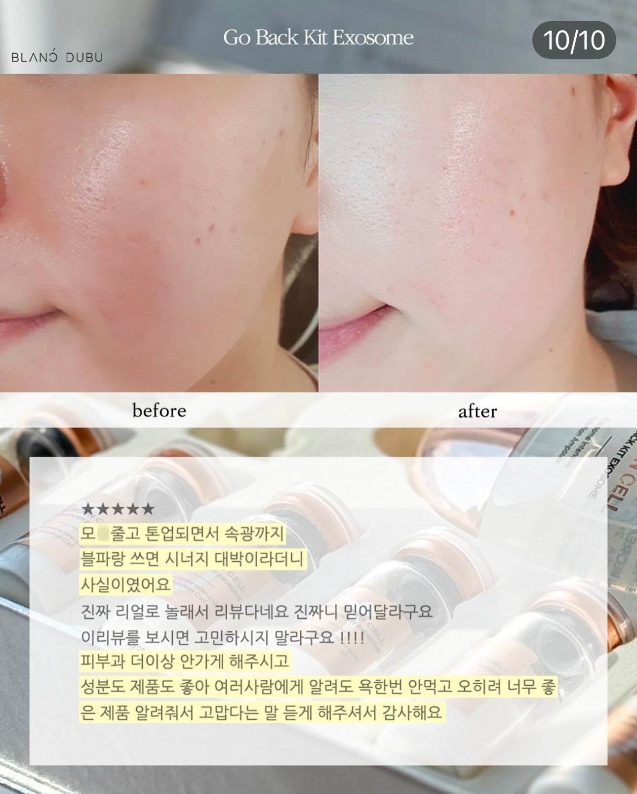 Blanc Dubu - Nuborn Cell Go Back Kit Exosome