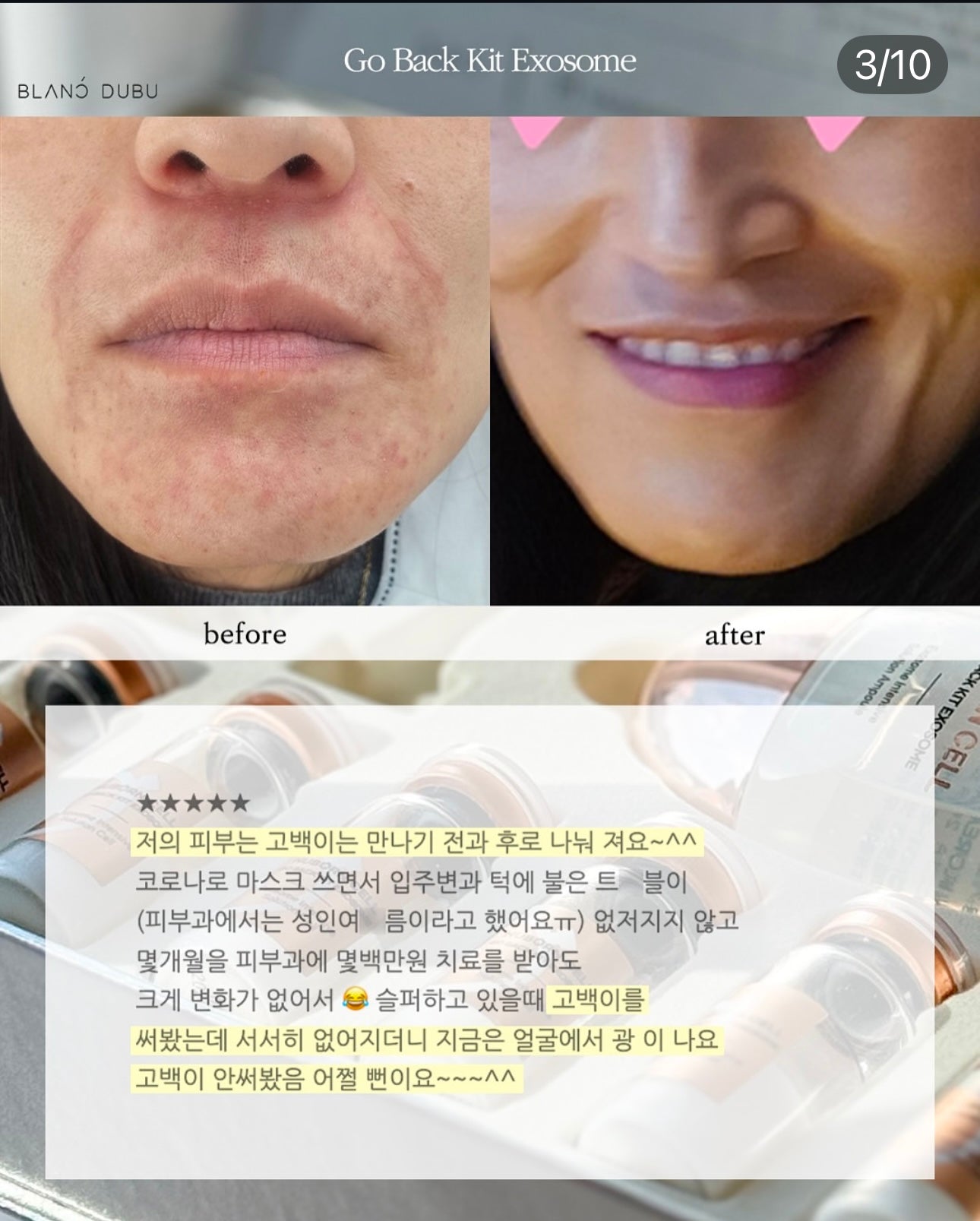 Blanc Dubu - Nuborn Cell Go Back Kit Exosome