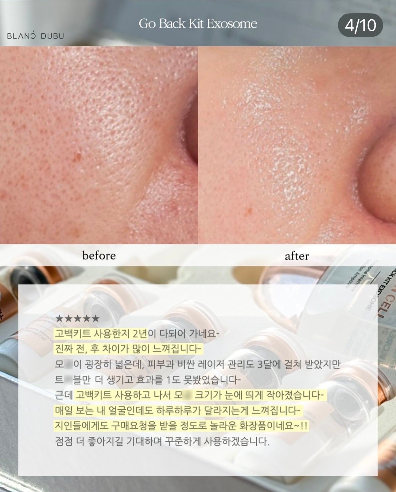 Blanc Dubu - Nuborn Cell Go Back Kit Exosome