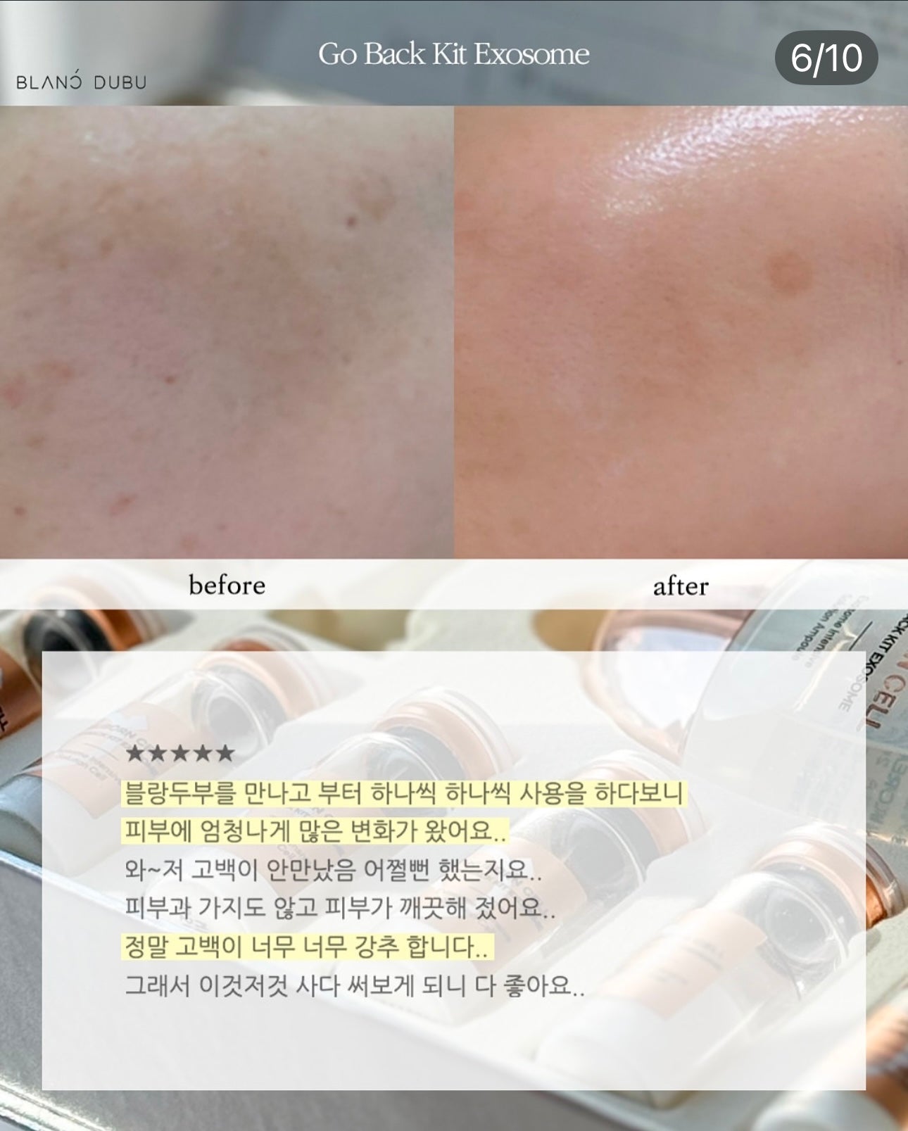 Blanc Dubu - Nuborn Cell Go Back Kit Exosome