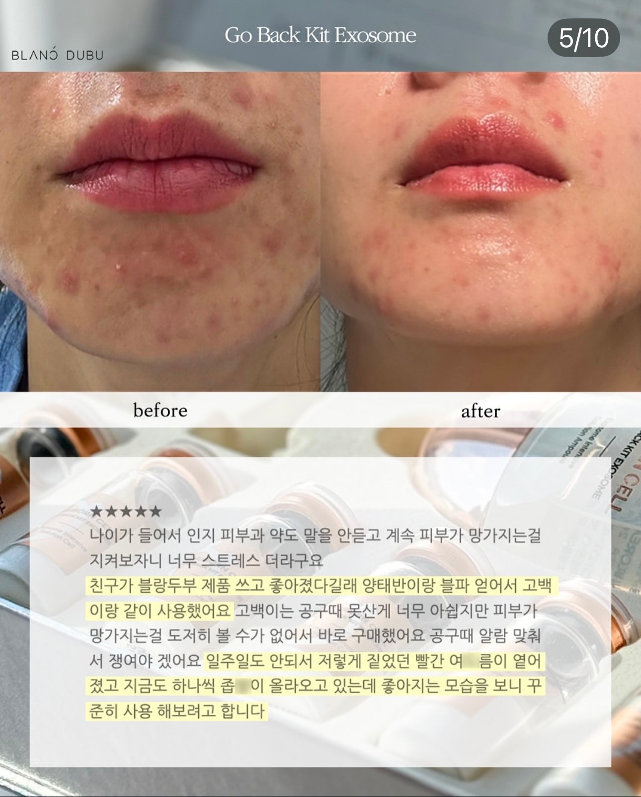 Blanc Dubu - Nuborn Cell Go Back Kit Exosome
