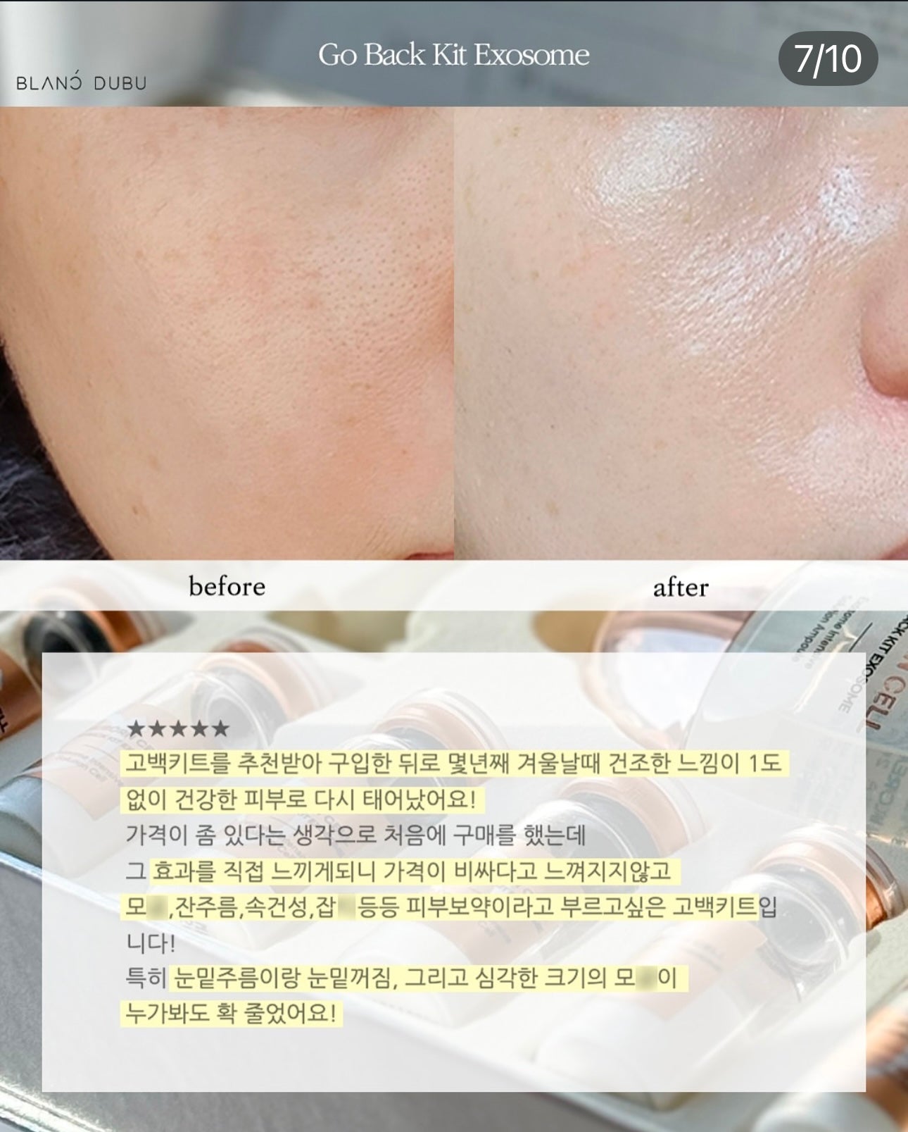 Blanc Dubu - Nuborn Cell Go Back Kit Exosome